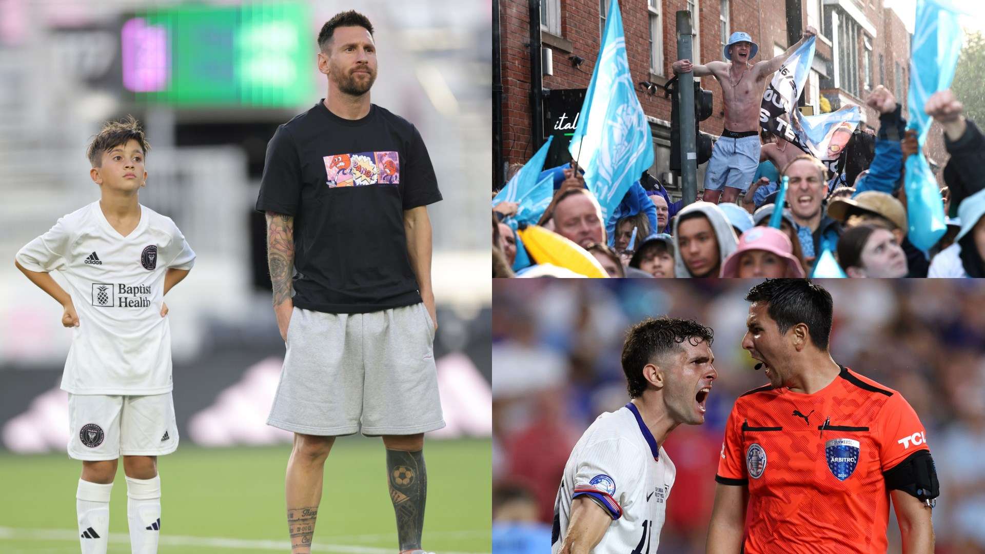 教练团队针 教练团队针